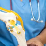 Top 10 Knee Replacement Surgeons in Delhi NCR