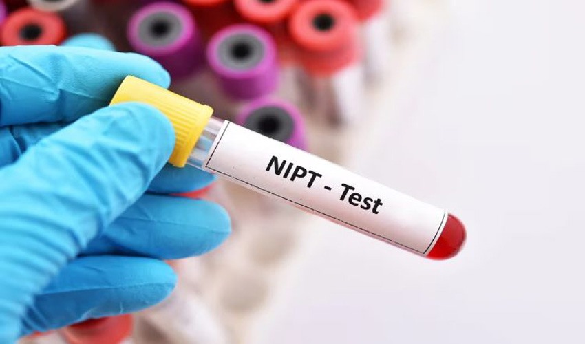 NIPT Test in Bangalore Availability, Process, and Where to Get Tested